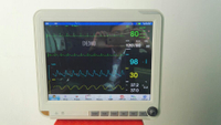 Monitor paziente multiparametrico portatile da 15 pollici dell'attrezzatura medica HM-2000E