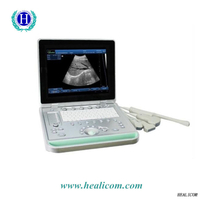 Vendita calda HBW-9 Sistema di diagnosi portatile Macchina ad ultrasuoni 3D portatile B/W Ultrasuoni