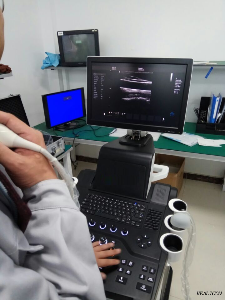 Apparecchiatura medica HUC-600P Scanner a ultrasuoni doppler a colori di tipo 4D a carrello completamente digitale
