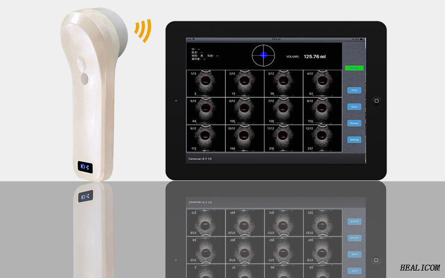 Macchina ad ultrasuoni Scanner senza fili della vescica Mini sonda a ultrasuoni
