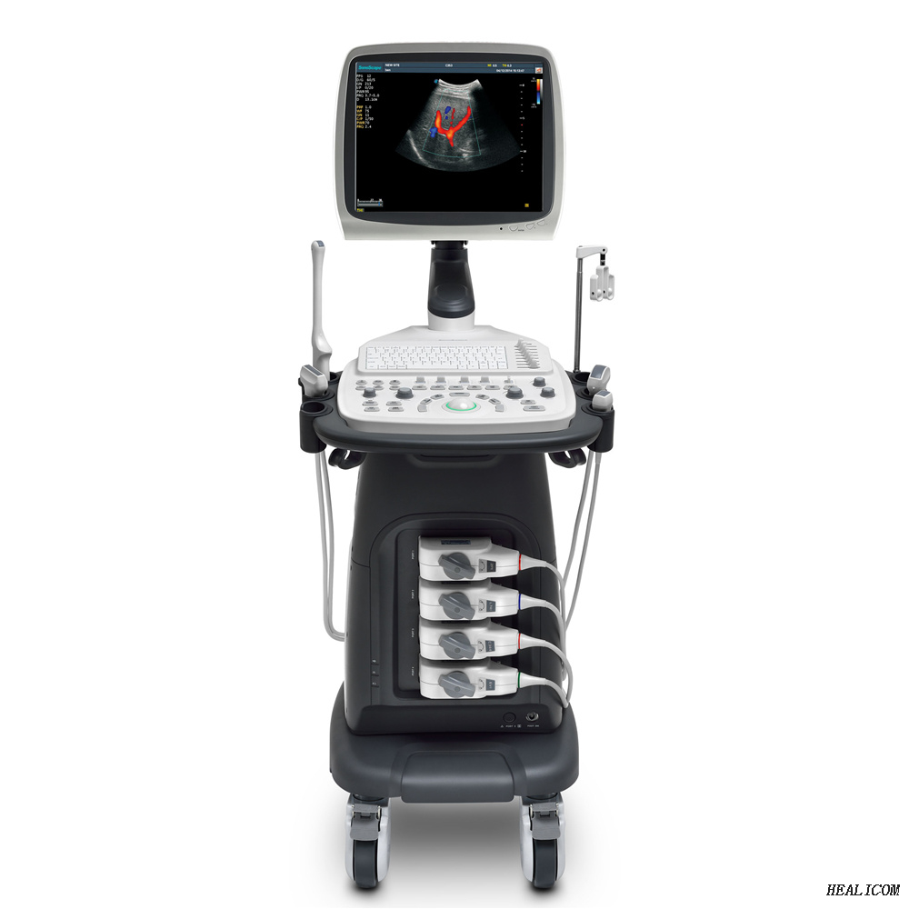 Scanner ad ultrasuoni Doppler a colori per carrello ad ultrasuoni completamente digitale Sonoscape S12 di alta qualità