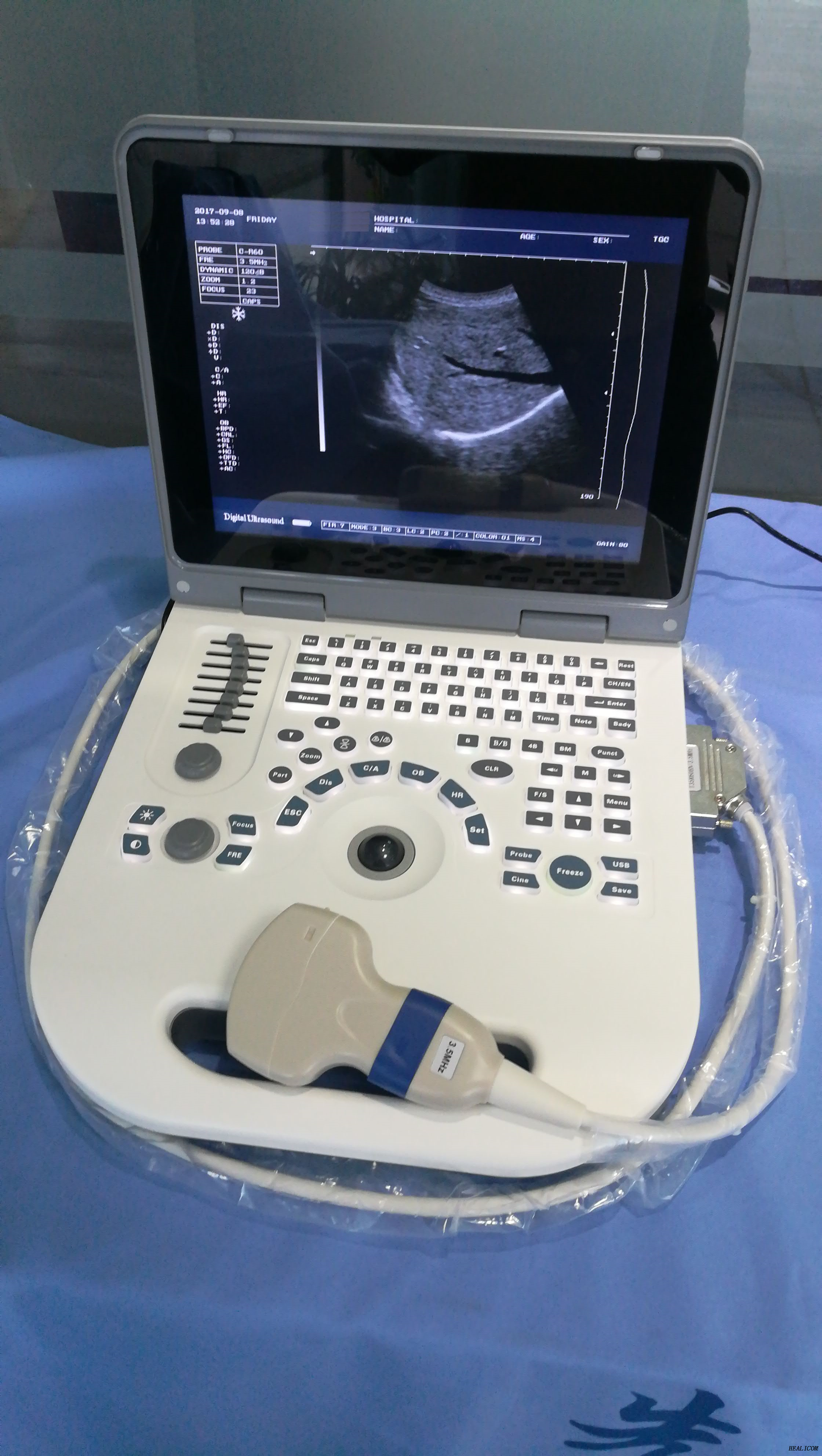 Apparecchiature diagnostiche HBW-3 Plus Ultrasuoni portatili Full Digital portatili