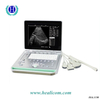 Macchina ad ultrasuoni portatile 3D per apparecchiature mediche HBW-7 di alta qualità