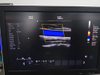 Apparecchiatura medica HUC-600P Scanner a ultrasuoni doppler a colori di tipo 4D a carrello completamente digitale